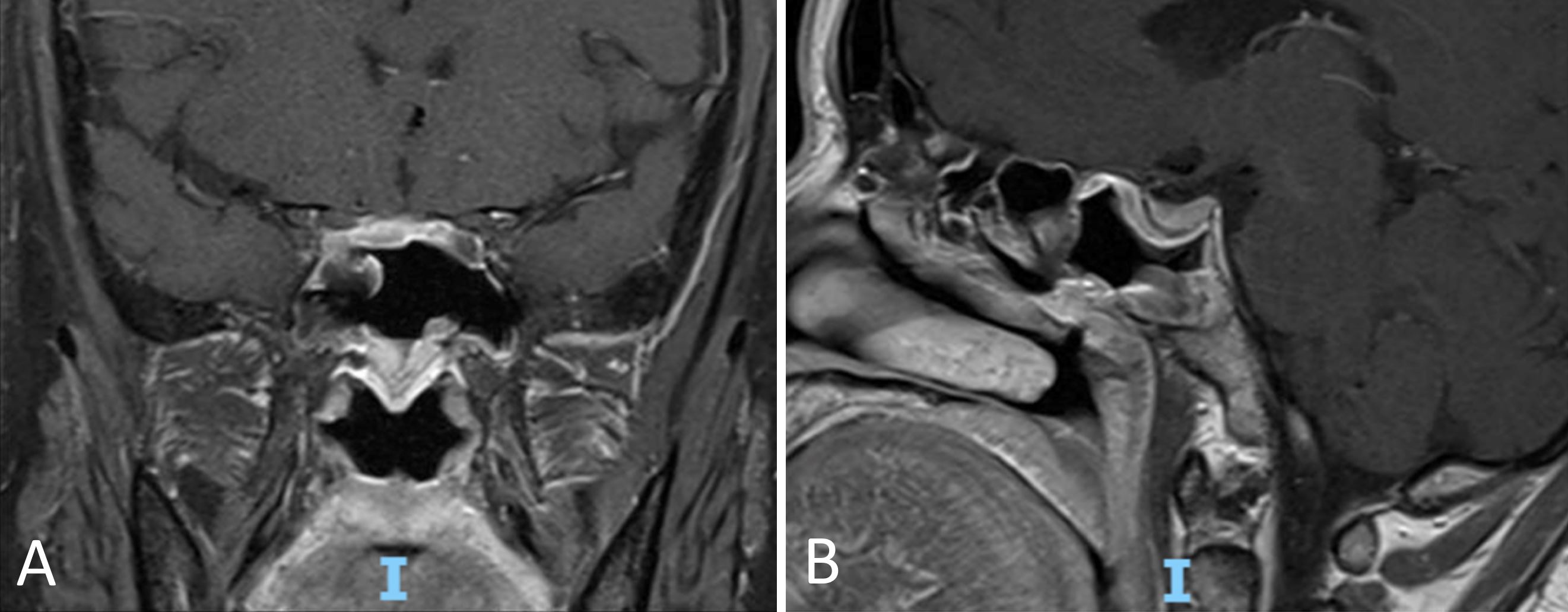 Figure 3.JPG